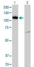Western blot of LLGL2 expression in transfected 293T cell line by LLGL2 monoclonal antibody (M06), clone 4G2.