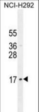 LLPH Antibody western blot of NCI-H292 cell line lysates (35 ug/lane). The LLPH antibody detected the LLPH protein (arrow).