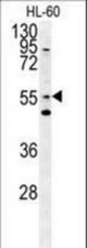 LMA1L Antibody western blot of HL-60 cell line lysates (15 ug/lane). The LMA1L antibody detected the LMA1L protein (arrow).