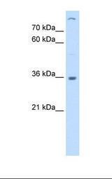 Jurkat cell lysate. Antibody concentration: 0.25 ug/ml. Gel concentration: 12%.