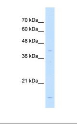 Jurkat cell lysate. Antibody concentration: 1.0 ug/ml. Gel concentration: 12%.