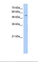 HepG2 cell lysate. Antibody concentration: 0.25 ug/ml. Gel concentration: 12%.