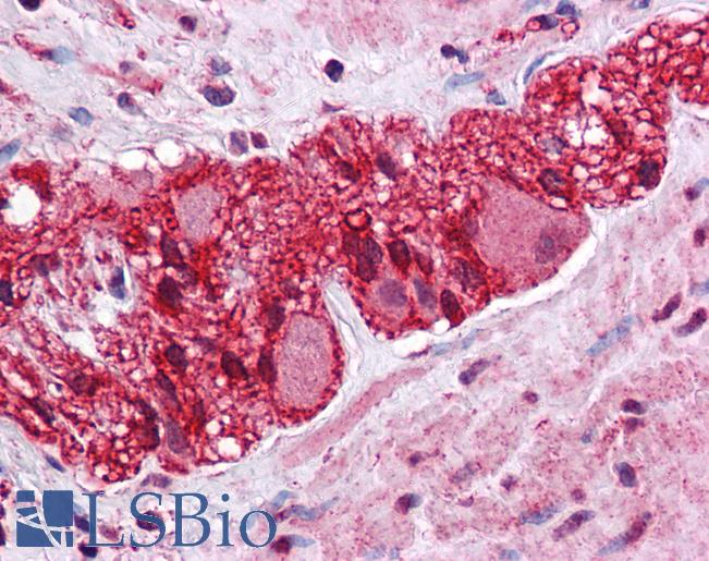 Anti-LMBRD1 antibody IHC of human colon, myenteric plexus. Immunohistochemistry of formalin-fixed, paraffin-embedded tissue after heat-induced antigen retrieval. Antibody LS-B5352 concentration 5 ug/ml.