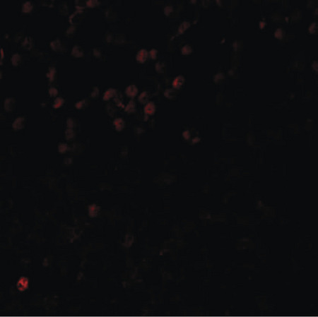 Immunofluorescence of LMBRD1 in human brain tissue with LMBRD1 antibody at 20 ug/ml.