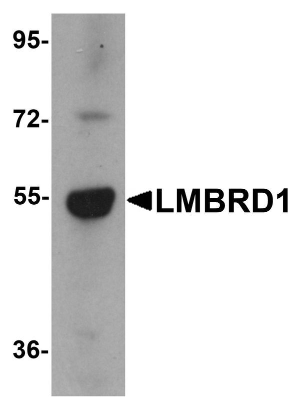 Western blot analysis of LMBRD1 in human brain tissue lysate with LMBRD1 antibody at 1 ug/ml.
