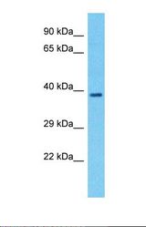 Western blot of Human Lung Tumor. LMF1 antibody dilution 1.0 ug/ml.