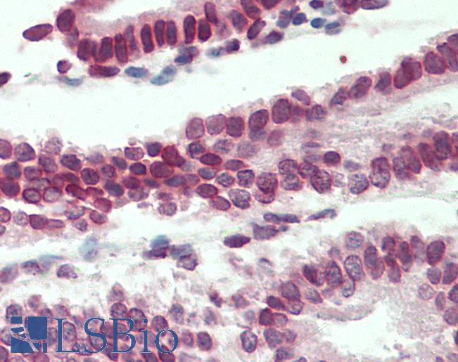 Anti-LMNB1 / Lamin B1 antibody IHC staining of human uterus. Immunohistochemistry of formalin-fixed, paraffin-embedded tissue after heat-induced antigen retrieval. Antibody LS-B11184 concentration 5 ug/ml.