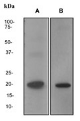 Western blot analysis on (A) Raji cell lysate and (B) Fetal kidney lysate using anti-LMO2 antibody (LS-C105610).
