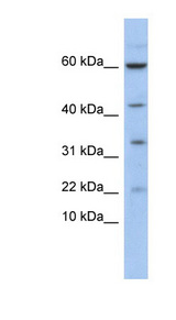LMO2 antibody LS-C112371 Western blot of Fetal Kidney lysate.