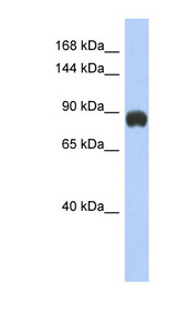 GRM6 / MGLUR6 antibody LS-C109620 Western blot of Fetal Small Intestine lysate.