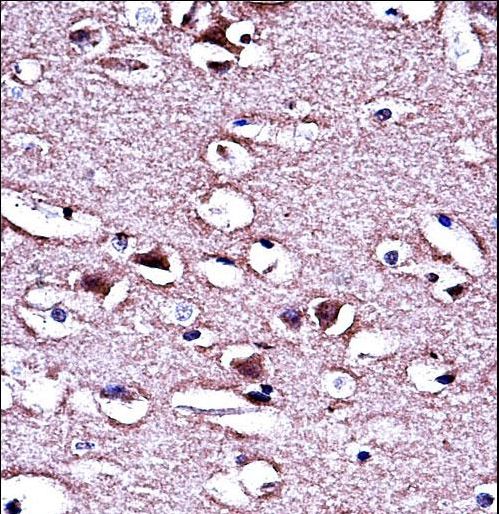 LMO2 Antibody immunohistochemistry of formalin-fixed and paraffin-embedded human brain tissue followed by peroxidase-conjugated secondary antibody and DAB staining.