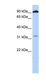 GRM6 / MGLUR6 antibody LS-C102733 Western blot of 721_B cell lysate.