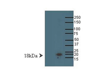 WB: LMO4 Western blot on MCF-7 human breast carcinoma cell line lysate.