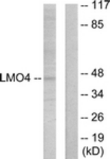 Western blot of extracts from 293 cells, using LMO4 Antibody. The lane on the right is treated with the synthesized peptide.
