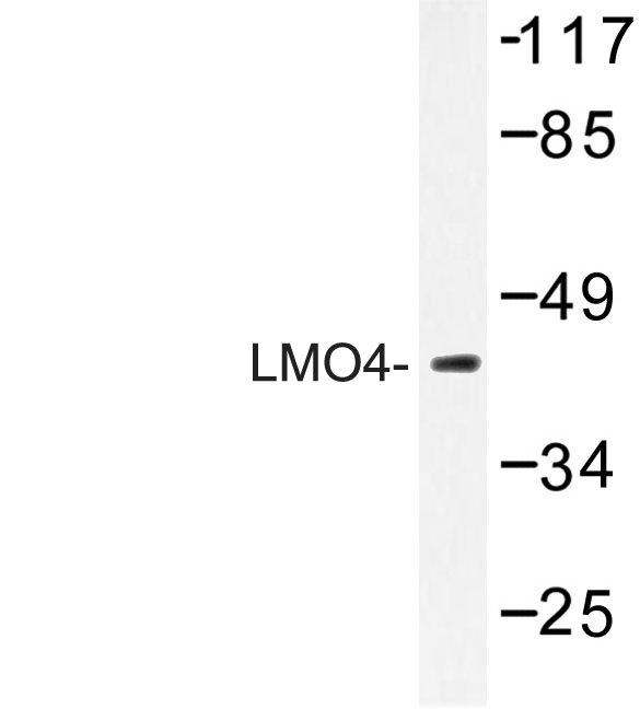 Western blot of LMO4 (E138) pAb in extracts from 293 cells.
