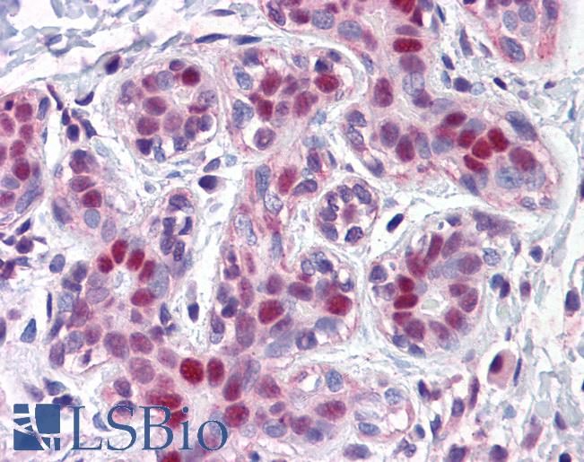 Anti-LMO4 antibody IHC of human breast. Immunohistochemistry of formalin-fixed, paraffin-embedded tissue after heat-induced antigen retrieval. Antibody LS-B4469 concentration 5 ug/ml.