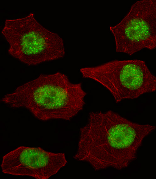 Fluorescent image of A549 cell stained with LMO4 Antibody. A549 cells were fixed with 4% PFA (20 min), permeabilized with Triton X-100 (0.1%, 10 min), then incubated with LMO4 primary antibody (1:25, 1 h at 37°C). For secondary antibody, Alexa Fluor 488 conjugated donkey anti-rabbit antibody (green) was used (1:400, 50 min at 37°C). Cytoplasmic actin was counterstained with Alexa Fluor 555 (red) conjugated Phalloidin (7units/ml, 1 h at 37°C). LMO4 immunoreactivity is localized to Nucleus significantly.