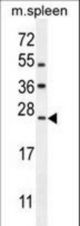 LMO4 Antibody western blot of mouse spleen tissue lysates (35 ug/lane). The LMO4 antibody detected the LMO4 protein (arrow).
