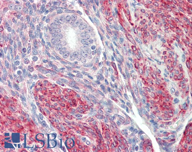 Anti-LMOD1 antibody IHC staining of human uterus. Immunohistochemistry of formalin-fixed, paraffin-embedded tissue after heat-induced antigen retrieval. Antibody LS-B10328 concentration 5 ug/ml.