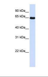 Placenta lysate. Antibody concentration: 1.0 ug/ml. Gel concentration: 12%.