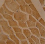 LMOD2 antibody immunohistochemistry of formalin-fixed and paraffin-embedded human skeletal muscle followed by peroxidase-conjugated secondary antibody and DAB staining.