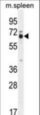 LMOD2 Antibody western blot of mouse spleen tissue lysates (35 ug/lane). The LMOD2 antibody detected the LMOD2 protein (arrow).