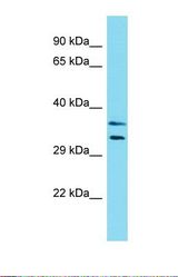 Western blot of Human HCT15. LMOD3 antibody dilution 1.0 ug/ml.