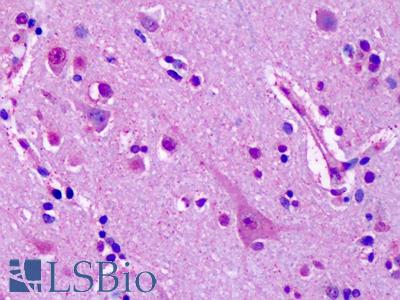 Anti-GRM7 / MGLUR7 antibody IHC of human brain, cortex, neurons. Immunohistochemistry of formalin-fixed, paraffin-embedded tissue after heat-induced antigen retrieval. Antibody LS-A2694 dilution 10 ug/ml.