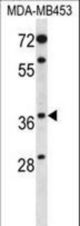 PAQR8 Antibody western blot of MDA-MB453 cell line lysates (35 ug/lane). The PAQR8 antibody detected the PAQR8 protein (arrow).