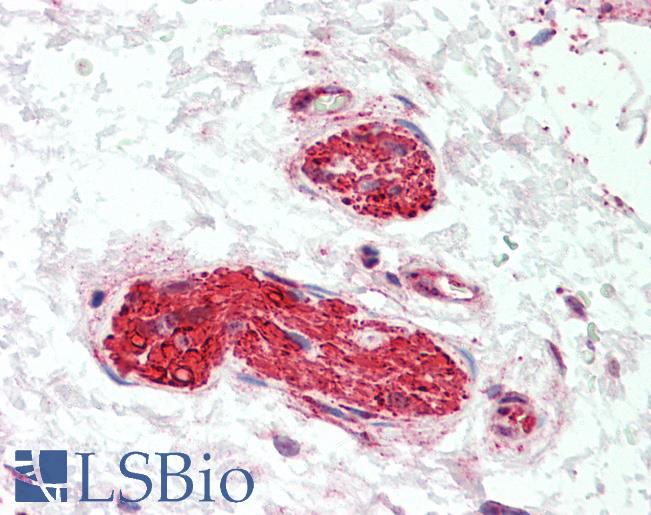 Anti-LMTK3 antibody IHC staining of human nerve. Immunohistochemistry of formalin-fixed, paraffin-embedded tissue after heat-induced antigen retrieval. Antibody LS-B9975 concentration 10 ug/ml.