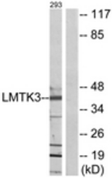 Western blot of extracts from 293 cells, using LMTK3 Antibody. The lane on the right is treated with the synthesized peptide.