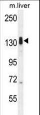 LMTK3 Antibody western blot of mouse liver tissue lysates (35 ug/lane). The LMTK3 antibody detected the LMTK3 protein (arrow).