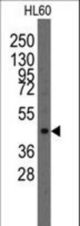Western blot of anti-Lmx1a antibody in HL60 cell line lysates (35 ug/lane). Lmx1a(arrow) was detected using the purified antibody.