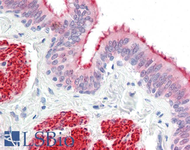 Anti-LMX1A antibody IHC staining of human lung, bronchiole. Immunohistochemistry of formalin-fixed, paraffin-embedded tissue after heat-induced antigen retrieval.