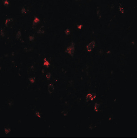 Immunofluorescence of LMX1A in human brain tissue with LMX1A antibody at 20 ug/ml.
