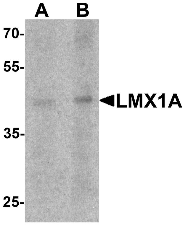 Western blot analysis of LMX1A in rat brain tissue lysate with LMX1A antibody at (A) 1 and (B) 2 ug/ml.