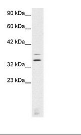 Jurkat Cell Lysate