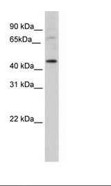 SP2/0 Cell Lysate