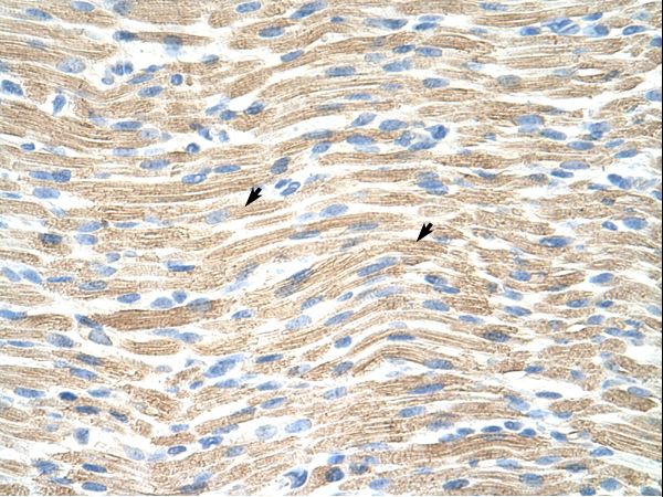 LMX1A antibody LS-C31594 was used in IHC to stain formalin-fixed, paraffin-embedded human muscle.