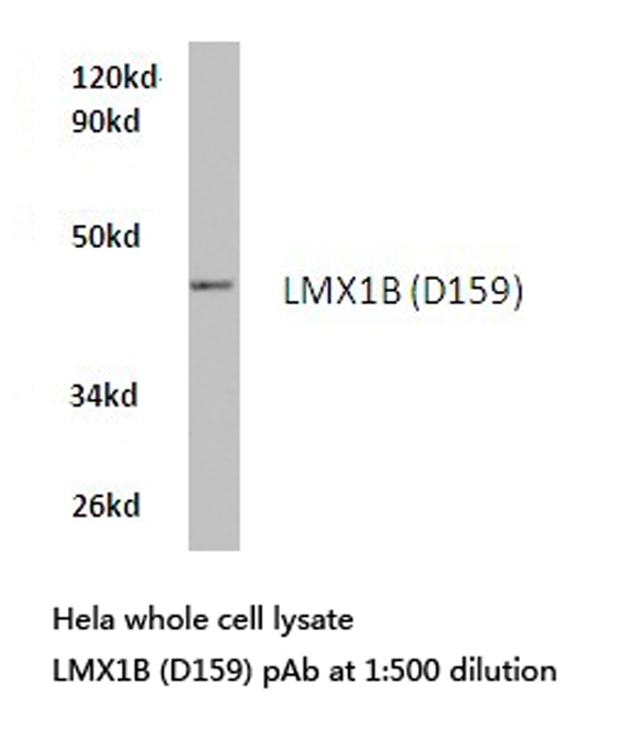 Western blot of LMX1B (D159) pAb in extracts from HeLa cells.