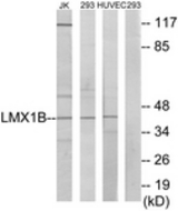 Western blot of extracts from Jurkat/293/HUVEC cells, using LMX1B Antibody. The lane on the right is treated with the synthesized peptide.