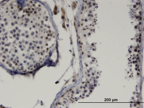 Immunoperoxidase of monoclonal antibody to LMX1B on formalin-fixed paraffin-embedded human testis. [antibody concentration 3 ug/ml]