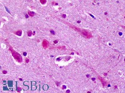 Anti-GRM7 / MGLUR7 antibody IHC of human brain, cortex. Immunohistochemistry of formalin-fixed, paraffin-embedded tissue after heat-induced antigen retrieval. Antibody LS-A918 dilution 4-6 ug/ml.