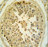 Formalin-fixed and paraffin-embedded human testis tissue reacted with LMX1B Antibody , which was peroxidase-conjugated to the secondary antibody, followed by DAB staining. This data demonstrates the use of this antibody for immunohistochemistry; clinical relevance has not been evaluated.