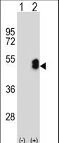 Western blot of LMX1B (arrow) using rabbit polyclonal LMX1B Antibody. 293 cell lysates (2 ug/lane) either nontransfected (Lane 1) or transiently transfected (Lane 2) with the LMX1B gene.