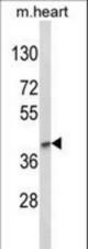 Western blot of LMX1B Antibody in mouse heart tissue lysates (35 ug/lane). LMX1B (arrow) was detected using the purified antibody.