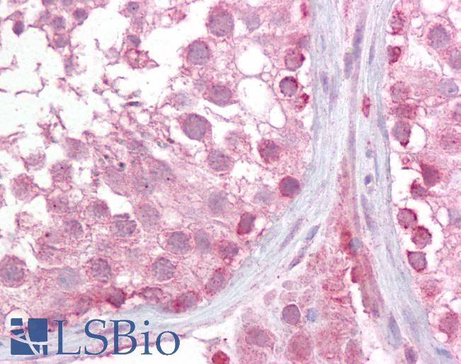 Anti-LMX1B antibody IHC of human testis. Immunohistochemistry of formalin-fixed, paraffin-embedded tissue after heat-induced antigen retrieval. Antibody LS-B6479 concentration 2.5 ug/ml.