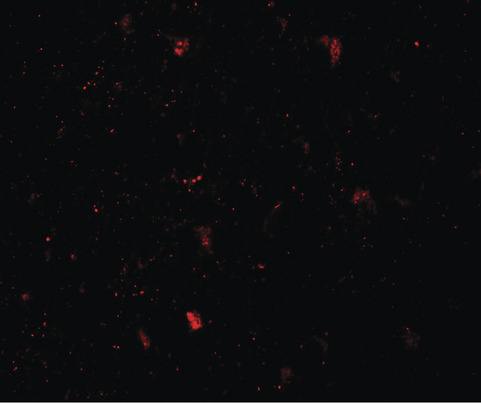 Immunofluorescence of LMX1B in human brain tissue with LMX1B antibody at 20 ug/ml.