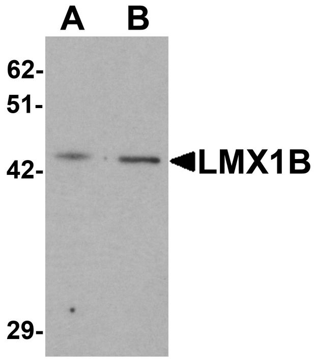 Western blot analysis of LMX1B in A-20 cell lysate with LMX1B antibody at (A) 1 and (B) 2 ug/ml.