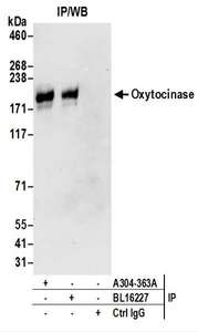 Detection of Human Oxytocinase by Western Blot of Immunoprecipitates. Samples: Whole cell lysate (0.5 or 1.0 mg per IP reaction; 20% of IP loaded) prepared using NETN buffer from Jurkat cells. Antibodies: Affinity purified rabbit anti-Oxytocinase antibody used for IP at 6 ug per reaction. Oxytocinase was also immunoprecipitated by rabbit anti-Oxytocinase antibody BL16227. For blotting immunoprecipitated Oxytocinase, was used at 1 ug/ml. Detection: Chemiluminescence with an exposure time of 30 seconds.